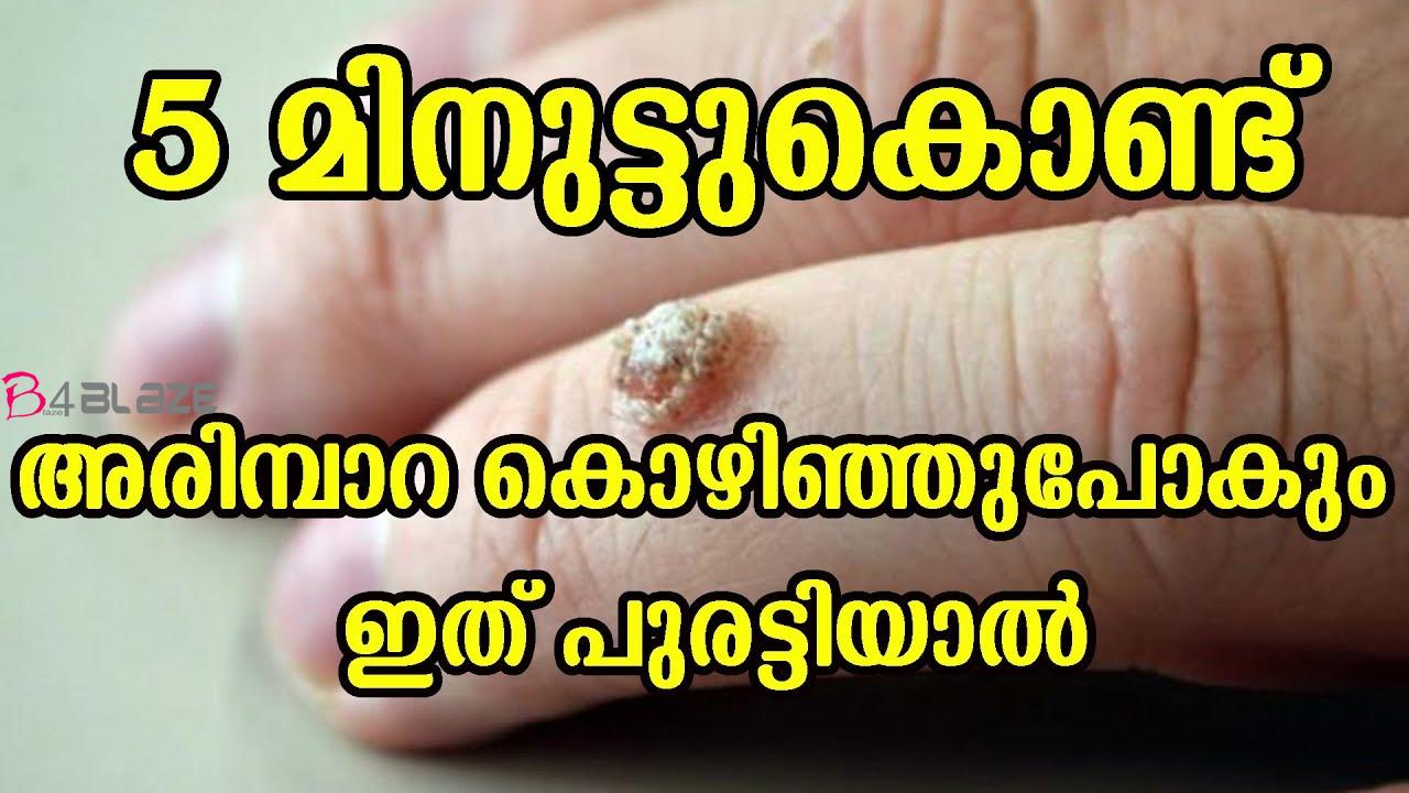 home remedies for arimbara removing